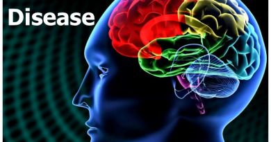 Lumina care pâlpâie cu 40 Hz poate combate boala Alzheimer Lumina care pâlpâie cu 40 Hz poate combate boala Alzheimer